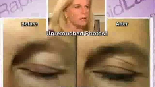 Rapid Lash - YouTube Poop смотреть онлайн