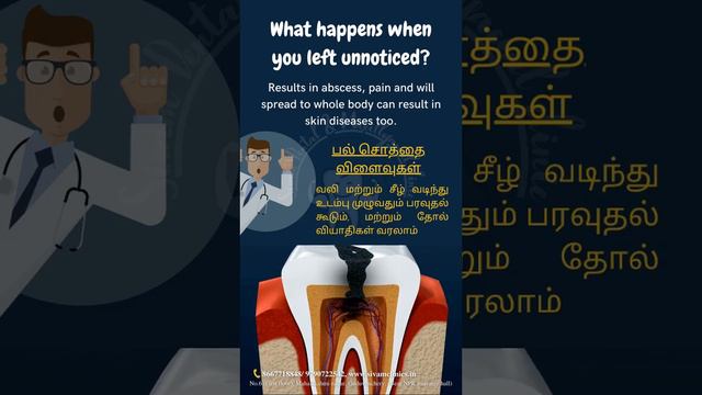 What does DENTAL CARIES lead to??.. #dentalcaries #dentalawareness