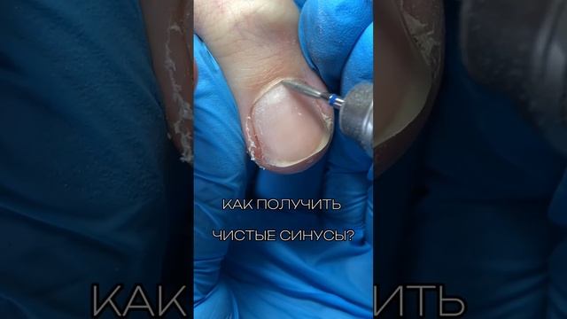 Чистые синусы. Переходи в инсту @dinara.seilova_school папка ПЕДИКЮР #педикюр #курсыпедикюра