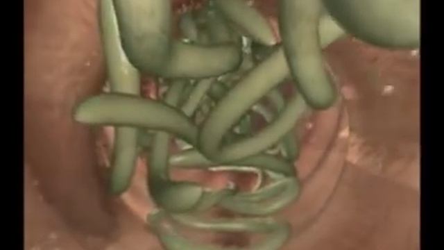 глисты у собак смотреть онлайн