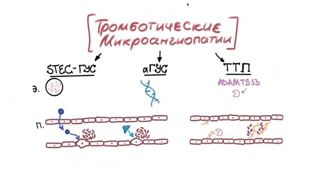 Тромботические микроангиопатии. Этиология, патогенез и клиническая картина. смотреть онлайн