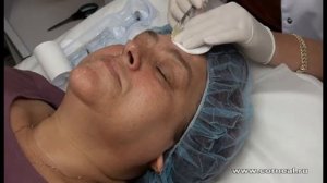 Учимся колоть биоревитализацию