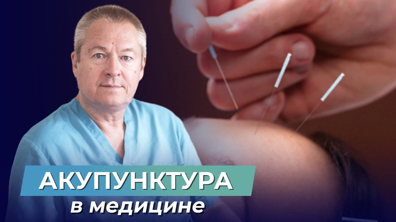 МИФЫ МЕДИЦИНЫ! Почему необходимо не ЗАЛЕЧИВАТЬ болезни, а работать над причиной? Акупунктура что это