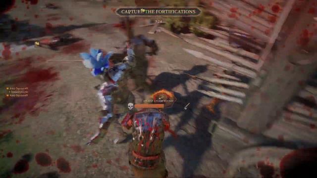 Chivalry 2 - No Arms No Problem