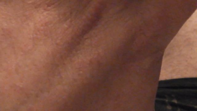 Псориаз- день четвертый 1 смотреть онлайн