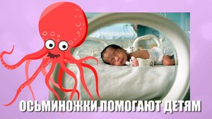 Как вязанные ОСЬМИНОГИ помогают НОВОРОЖДЕННЫМ? Истории из жизни.
