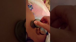 банки на спине у ребенка. массаж банками.