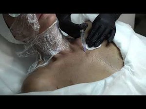 Мезоботокс Jalupro