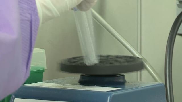 Zika IgM ELISA смотреть онлайн