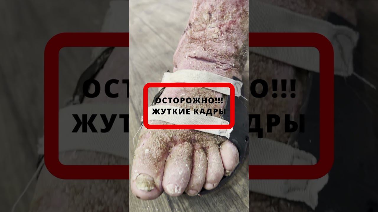 Жизнь реб.центра. Ред Хилл Кемерово. Его знали все,но не знали,как помочь.
