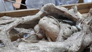 Анатомия. Разбор трупа. Ч.2