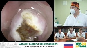 28. Дивертикул Ценкера. К. В. Шишин