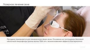 Лазерное лечение акне и постакне с помощью Fotona Dynamis Pro