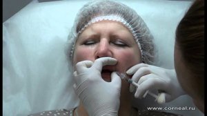 Не трогаем кисет - увеличиваем объем и обозначаем контур губ