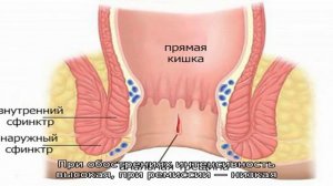 Зуд в анусе