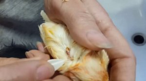 Удаление вросшего пера выкручиванием, часть 1.