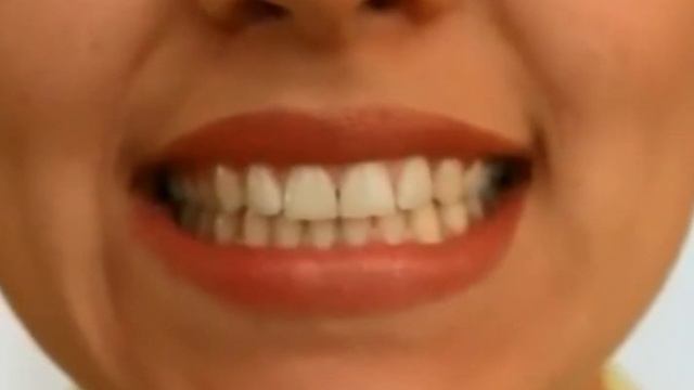 Артикуляционная гимнастика смотреть онлайн