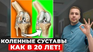 ГЛАВНЫЙ СЕКРЕТ здоровых КОЛЕНЕЙ! Как вылечить коленные суставы в домашних условиях?