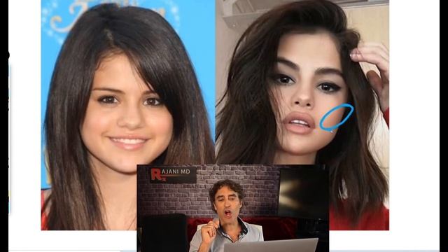 SELENA GOMEZ PLASTIC SURGERY // Celebrity Transformation смотреть онлайн