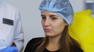 Коррекция скул и губ при помощи филлеров