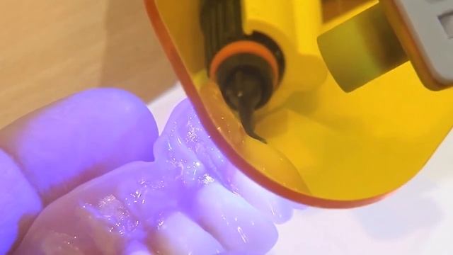 Виды зубных коронок смотреть онлайн