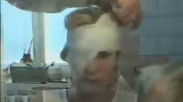 Повязка на один глаз смотреть онлайн