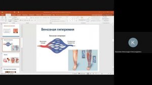 Нарушения периферического кровообращения