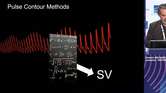 Pressure-derived parameter and stroke volume Frederic Michard