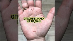 Опасные знаки на руке
