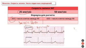 Урок 4. Анализ ЭКГ (опеределение источника и регулярности ритма, расчет ЧСС, ЭОС и позиции сердца).