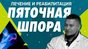 Пяточная шпора, как возникает, лечение и реабилитация | Здоровье ног