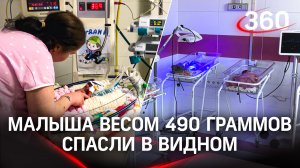 Недоношенным детям меньше 500 граммов дарят жизнь в Видновском перинатальном центре
