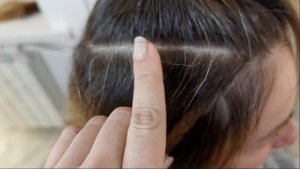 Отвалились волосы. Что делать? Как спасти волосы.