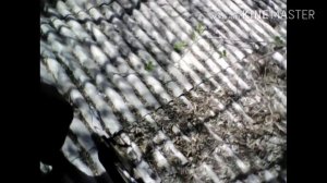 Упал на шифер и сломал(прыжок от Бога)