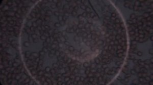 Эритроциты, лейкоциты и тромбоциты в микроскоп, бактерия поедает