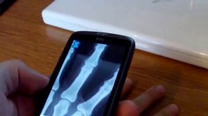 X Ray Scanner for Android