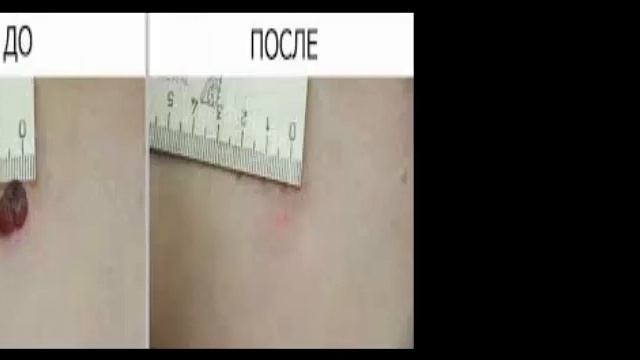 Родинки смотреть онлайн