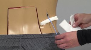 Your Nephrostomy or Nephroureteral Drain