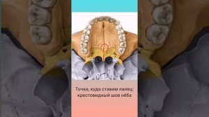 Упражнения при мезиальном прикусе