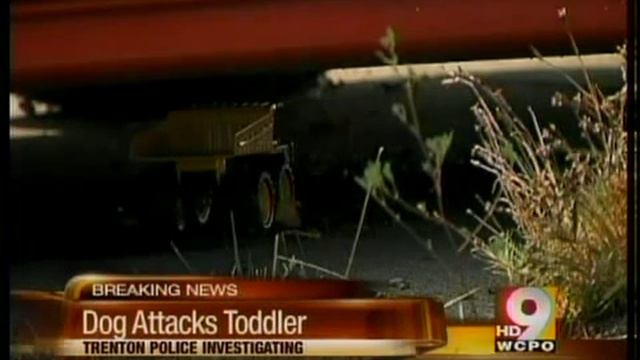 Toddler attacked by family dog смотреть онлайн