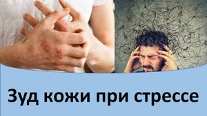 Зуд кожи после стресса.