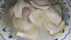 Увеличение губ: странная мода на диспропорцию