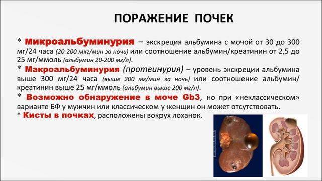 Болезнь Фабри
