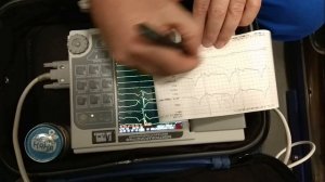 ЭКГ ПО СЛОПАКУ