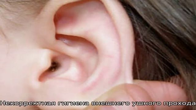 Почему образуются пробки в ушах смотреть онлайн