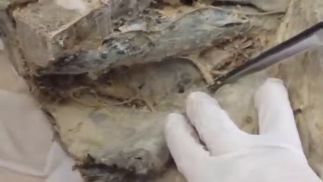 Грудные нервы  Поясничное сплетение  Plexus Lumbalis