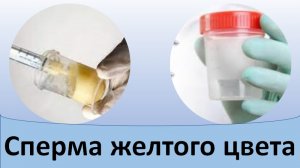Сперма желтого цвета. Причины. Что делать?