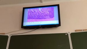 Гистология. Толстая кишка