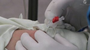 катетеризация левой лучевой артерии