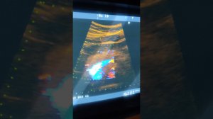 Практическое занятие. Методика УЗИ органов брюшной полости 1.